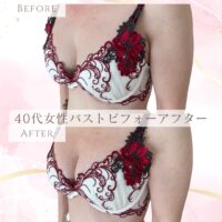 こんなにも？！40代女性バストビフォーアフター！