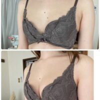 30代・40代の授乳後加齢によるデコルテ削げ諦めないで