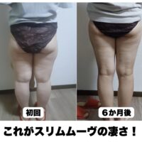 これがスリムムーヴの凄さ！6ヶ月後の後ろ姿